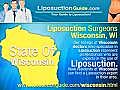 Liposuction Wisconsin