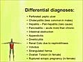 USMLE Step 2 CS - Acute  Abdomen