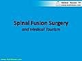 Spinal Fusion Surgery for Pain,  Sciatica & Stenosis: Medical Tourism