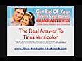 How To Get Rid Of Tinea Versicolor Naturally