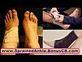 Sprained Ankle tratment Common Sports Injuries