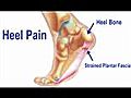 Heel Pain Treatment - Podiatrist in Wappingers Falls,  Dutchess County, Hudson Valley and Poughkeepsie