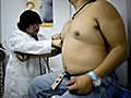 Obesidad cuesta anualmente 3 mil 500 mdd: Calderón