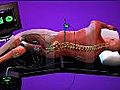 Technology making back surgery less invasive