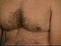 Medical Male Breast Exam