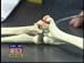 Surgery For A Common Baseball Injury