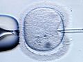 Bundestag stimmt für Embryonen-Gentest