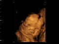 4d baby scan video 23 week baby of  Daniela and James