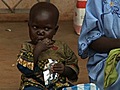 Malnutrition: the long-term response