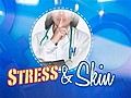 Causes of stress: Oily skin,  hair loss