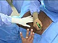 Minimally Invasive Hysterectomy