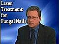 San Leandro,  CA- Nail Fungus Treatment