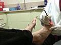 Laser treatment shows promise for toenail fungus
