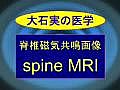 頸椎MRI