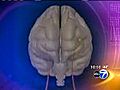 Healthbeat Report: Hearts and Headaches