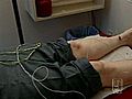 Acupuncture Helps Relieve Symptoms,  Many Say