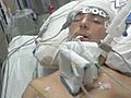 Teen in coma after beating