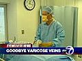 New quick and almost-pain free vericose veins treament