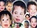 3 in 2000 babies born with Down&#039;s Syndrome