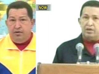 Chavez Reveals New Details on Health Problems