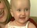 Baby Girl Saved By Medical Super Glue