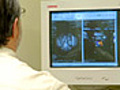 Improving the Survival Rate of Liver Cancer Patients