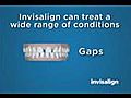 Anaheim Hills Invisalign Invisible Braces Non Metal Braces