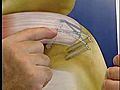 [Video] New,  less invasive method repairs torn rotator cuff