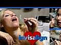 Love Invisalign