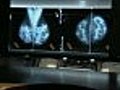 Fewer Women Getting Mammograms