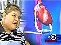 Teen gets partial artificial heart