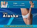 Lipo Alaska