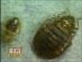 Md. Couple Sues Over Bedbugs In Apartment