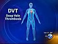 Healthbeat Report: Blood Clots