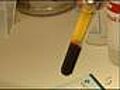 Plasma sanguíneo para estar deslumbrantes
