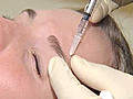 Botox Goes Beyond Battling Wrinkles