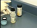 Testing Urine for Protein and Glucose