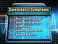 Treating Sarcoidosis