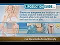 Liposuction Illinois