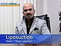 Liposuction nedir,  nasil uygulanir?