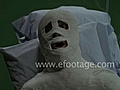 PATIENT IN FULL-BODY CAST - 2 - HD