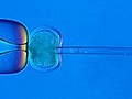 Bundestag stimmt für Gentests an Embryonen