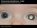 Retinoblastoma treatment in India at leading eye clinics