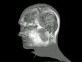 3D MRI Brain Anatomy