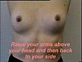 Breast Self-Examination