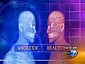 Healthbeat Report: Understanding Anorexia