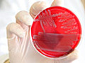 E coli outbreak tests German scientists and relations with Spain - video