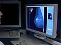 Half of women over 40 get annual mammograms