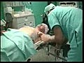 Breat Recurrence Cryosurgery