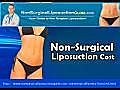 NonSurgical Liposuction Cost